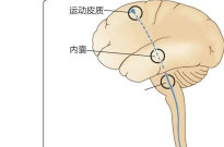 脑卒中的机制、高肌张力的病理生理学、临床表现、诊断与评估、治疗方法以及康复管理等问题