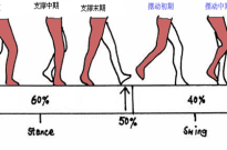 偏瘫后，走路膝关节控制能力差、不会打弯、膝过伸，该如何康复？