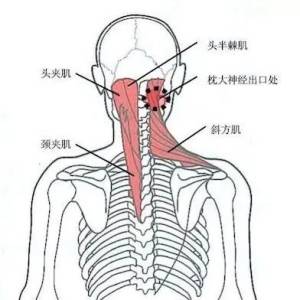 颈肩病常见的几个压痛点