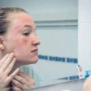 多变的“过敏”我们根据人体接触方式，将现实生活中常见的过敏原介绍如下 ...