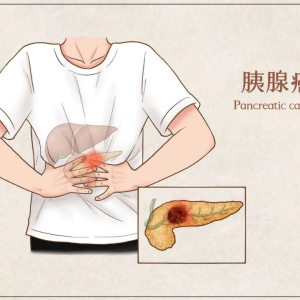 胰腺癌为什么是癌中之王？癌中之王——你知道多少？