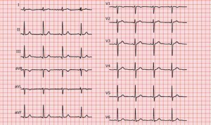 心电图、超声心动图、Holter......如何选择合适的心内科常规检查？ ...
